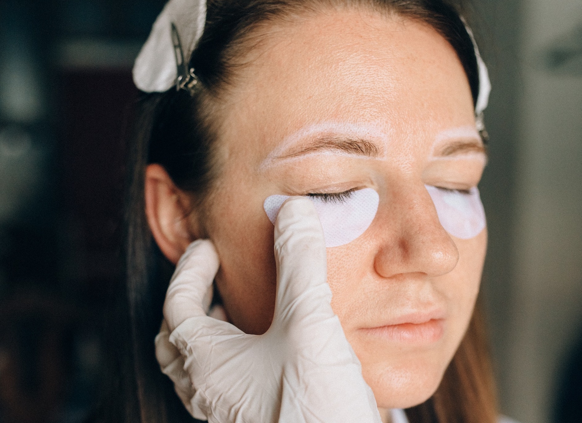 How To Remove Wrinkles Between Eyebrows Treatment Options